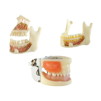 Dentare Dinți Model Mandibulei Model cu Balama Bucală Dentară Materiale Dentare Instrument