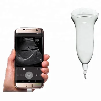 Healson U20C digital 2D USB portabil cu ultrasunete a sistemului/aparatului/sonda pentru terapie INTENSIVĂ/MSK/de urgență/abdomen sondă cu ultrasunete pret